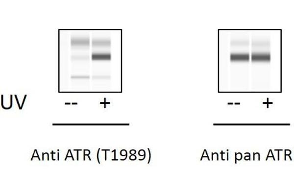 ATR ELISA Kit