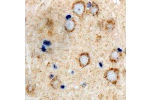 Immunohistochemical analysis of GLUR4 staining in human brain formalin fixed paraffin embedded tissue section. (GRIA4 Antikörper  (C-Term))