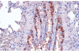 Immunohistochemistry of paraffin-embedded Rat lung using RPL22 Polyclonal Antibody at dilution of 1:100 (40x lens). (RPL22 Antikörper)
