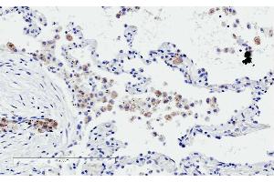 ABIN190752 (2µg/ml) staining of paraffin embedded Human Lung. (TREM2 Antikörper  (C-Term))