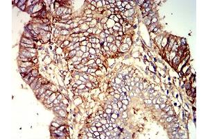 Immunohistochemistry (IHC) image for anti-CD276 (CD276) (AA 29-466) antibody (ABIN5611271)