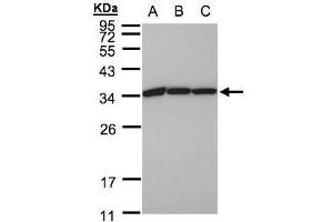 WB Image Sample(30 ug whole cell lysate) A:A431, B:H1299 C:HeLa S3, 12% SDS PAGE antibody diluted at 1:1000 (EEF1B2 Antikörper)