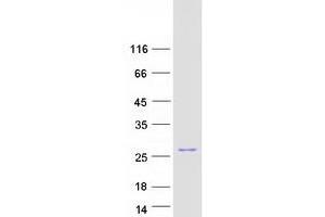 Validation with Western Blot (BAD Protein (Transcript Variant 1) (Myc-DYKDDDDK Tag))
