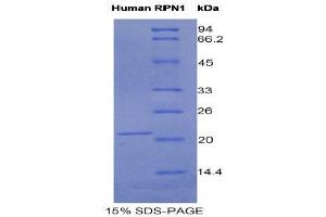SDS-PAGE (SDS) image for Ribophorin 1 (RPN1) (AA 24-179) protein (His tag) (ABIN1525575) (RPN1 Protein (AA 24-179) (His tag))