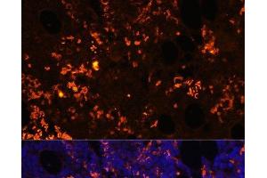 Immunofluorescence analysis of Rat bone marrow cells using GPR55 Polyclonal Antibody at dilution of 1:100. (GPR55 Antikörper)