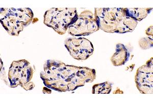 Immunohistochemistry (IHC) image for anti-Neuropilin 1 (NRP1) (AA 646-814) antibody (ABIN7425992)