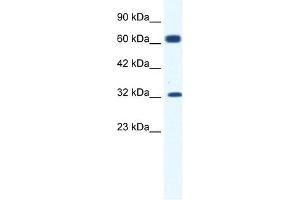 KCNN1 antibody used at 1. (KCNN1 Antikörper  (C-Term))