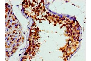 Immunohistochemistry of paraffin-embedded human testis tissue using ABIN7172893 at dilution of 1:100 (VCP Antikörper  (AA 704-806))