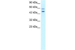 WB Suggested Anti-DKFZP761C169 Antibody Titration:  0. (GC-Rich Promoter Binding Protein 1 (GPBP1) (N-Term) Antikörper)