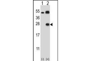 Western blot analysis of KLK6 (arrow) using rabbit polyclonal KLK6 Antibody  (ABIN652196 and ABIN2840742). (Kallikrein 6 Antikörper  (AA 126-156))