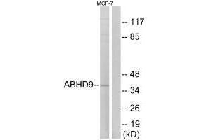 Western blot analysis of extracts from MCF-7 cells, using ABHD9 antibody. (ABHD9 Antikörper)