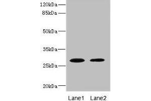 Western blot All lanes: TPK1 antibody at 0. (TPK1 Antikörper  (AA 1-243))