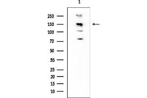 Western blot analysis of lysates from Mouse brain, using NFAT4 Mouse Monoclonal Antibody at 1/1000 dilution.