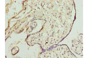 Immunohistochemistry (IHC) image for anti-DnaJ (Hsp40) Homolog, Subfamily B, Member 8 (DNAJB8) (AA 1-232) antibody (ABIN7150532)