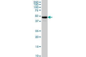 C17orf75 monoclonal antibody (M02), clone 2D7 Western Blot analysis of C17orf75 expression in HeLa .