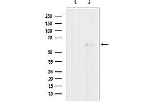 anti-Nuclear Receptor Binding Protein 1 (NRBP1) (Internal Region) antibody