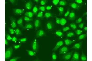Immunofluorescence analysis of A549 cell using FANCD2 antibody. (FANCD2 Antikörper)