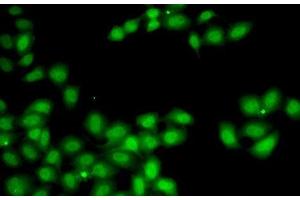 Immunofluorescence analysis of A-549 cells using GGH Polyclonal Antibody (GGH Antikörper)