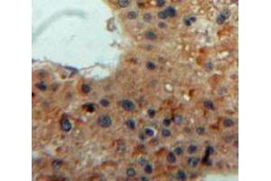 Used in DAB staining on fromalin fixed paraffin-embedded Liver tissue (Lipase A Antikörper  (AA 32-358))