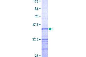 RPGR Protein (AA 1-100) (GST tag)