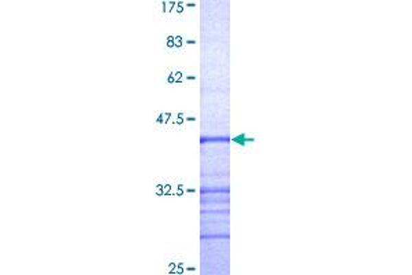 RPGR Protein (AA 1-100) (GST tag)