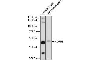Western blot analysis of extracts of various cell lines, using  antibody (ABIN7265502) at 1:1000 dilution. (ADRB1 Antikörper  (AA 150-250))