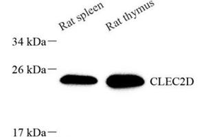 Western blot analysis of CLEC2D (ABIN7073248) at dilution of 1: 1000 (CLEC2D Antikörper)