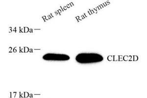 Western Blotting (WB) image for anti-C-Type Lectin Domain Family 2, Member D (CLEC2D) antibody (ABIN7073248)