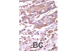 Immunohistochemistry (IHC) image for anti-Calcium/calmodulin-Dependent Protein Kinase II alpha (CAMK2A) antibody (ABIN3003046) (CAMK2A Antikörper)