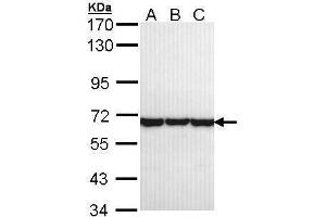 WB Image Sample (30 ug of whole cell lysate) A: A431 , B: H1299 C: Hela 7. (CCT8 Antikörper)