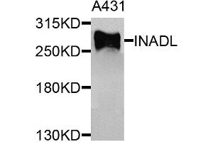 Western blot analysis of extracts of A431 cells, using INADL antibody. (PATJ Antikörper)