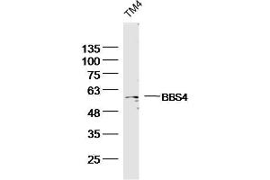 TM4 Mouse Cell lysates probed with BBS4 Polyclonal Antibody, unconjugated  at 1:300 overnight at 4°C followed by a conjugated secondary antibody for 60 minutes at 37°C. (BBS4 Antikörper  (AA 431-519))