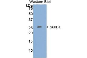 Western blot analysis of the recombinant protein. (CD79b Antikörper  (AA 37-226))