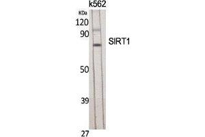 Western Blotting (WB) image for anti-Sirtuin 1 (SIRT1) (Tyr631) antibody (ABIN3177418) (SIRT1 Antikörper  (Tyr631))