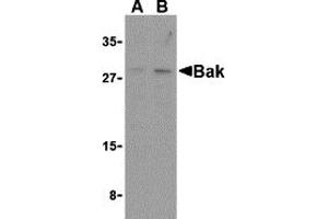 Western Blotting (WB) image for anti-BCL2-Antagonist/killer 1 (BAK1) (N-Term) antibody (ABIN1031258) (BAK1 Antikörper  (N-Term))