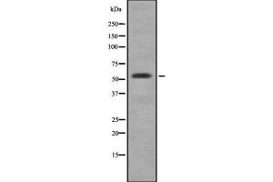 Western blot analysis of CYP3A5 using HepG2 whole cell lysates (CYP3A5 Antikörper)