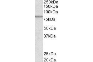 Western Blotting (WB) image for ATP-Binding Cassette, Sub-Family B (MDR/TAP), Member 5 (ABCB5) peptide (ABIN369721) (ATP-Binding Cassette, Sub-Family B (MDR/TAP), Member 5 (ABCB5) Peptid)