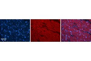 Rabbit Anti-SLC25A12 Antibody    Formalin Fixed Paraffin Embedded Tissue: Human Adult heart  Observed Staining: Cytoplasmic Primary Antibody Concentration: 1:100 Secondary Antibody: Donkey anti-Rabbit-Cy2/3 Secondary Antibody Concentration: 1:200 Magnification: 20X Exposure Time: 0. (SLC25A12 Antikörper  (Middle Region))