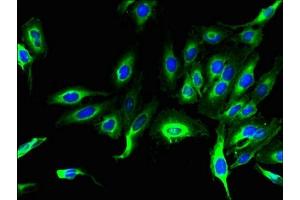 Immunofluorescent analysis of Hela cells using ABIN7158316 at dilution of 1:100 and Alexa Fluor 488-congugated AffiniPure Goat Anti-Rabbit IgG(H+L) (LHFPL1 Antikörper  (AA 21-85))