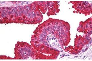 Anti-ABCA5 antibody IHC staining of human prostate. (ABCA5 Antikörper)