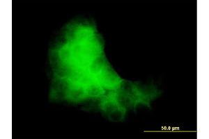 Immunofluorescence of monoclonal antibody to S100A7 on A-431 cell. (S100A7 Antikörper  (AA 1-101))