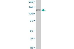 CAND1 monoclonal antibody (M03), clone 2D7. (CAND1 Antikörper  (AA 1-100))