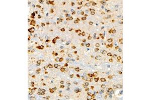 Immunohistochemistry of paraffin embedded mouse brain using P4H (ABIN7074215) at dilution of 1:700 (400x lens) (HIF Prolyl Hydroxylase Antikörper)