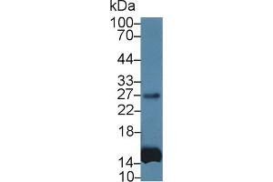 Detection of IL6 in Human Leukocyte lysate using Monoclonal Antibody to Interleukin 6 (IL6) (IL-6 Antikörper  (AA 27-212))