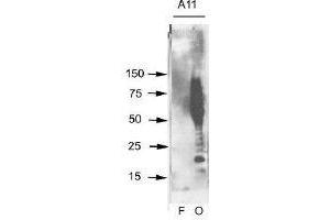 Aβ42 fibrils (F) and prefibrillar oligomers (O) were run on SDS polyacrylamide gels, transferred to nitrocellulose and probed with this antibody (A11). (Amyloid Oligomers Antikörper)