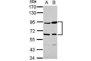 WB Image Sample (30 ug of whole cell lysate) A: Raji B: K562 7. (Complement Factor B Antikörper)