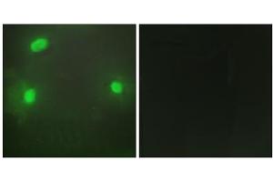 Immunofluorescence analysis of HeLa cells, using FEN1 antibody. (FEN1 Antikörper  (Internal Region))
