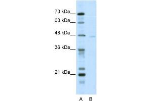WB Suggested Anti-TRIM38 Antibody Titration:  5.
