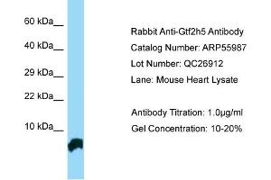 Western Blotting (WB) image for anti-General Transcription Factor IIH, Polypeptide 5 (GTF2H5) (N-Term) antibody (ABIN970845) (GTF2H5 Antikörper  (N-Term))