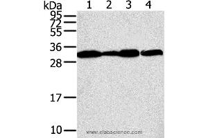 Western blot analysis of A375, A431, lovo and hela cell, using STX10 Polyclonal Antibody at dilution of 1:800 (Syntaxin 10 Antikörper)